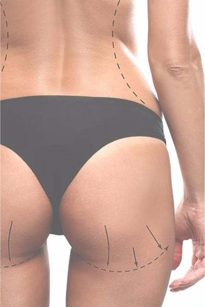 technique amincissement technique amincissement